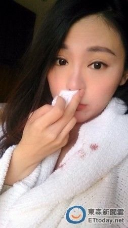 臺(tái)美女主播在京不適應(yīng)天氣流鼻血粉絲心疼獻(xiàn)計(jì)
